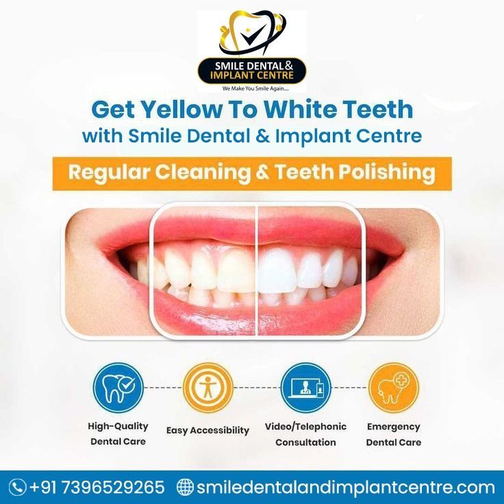 Smile brighter than ever before with our professional #TeethCleaning and #TeethPolishing service at #SmileDentalandImplantCentre in #Kapra, #Hyderabad. Book an Appointment now. +91-7396529265.
👉 More Info Visit: buff.ly/40mmfSW

#dentalclinicnearme #dentistnearme