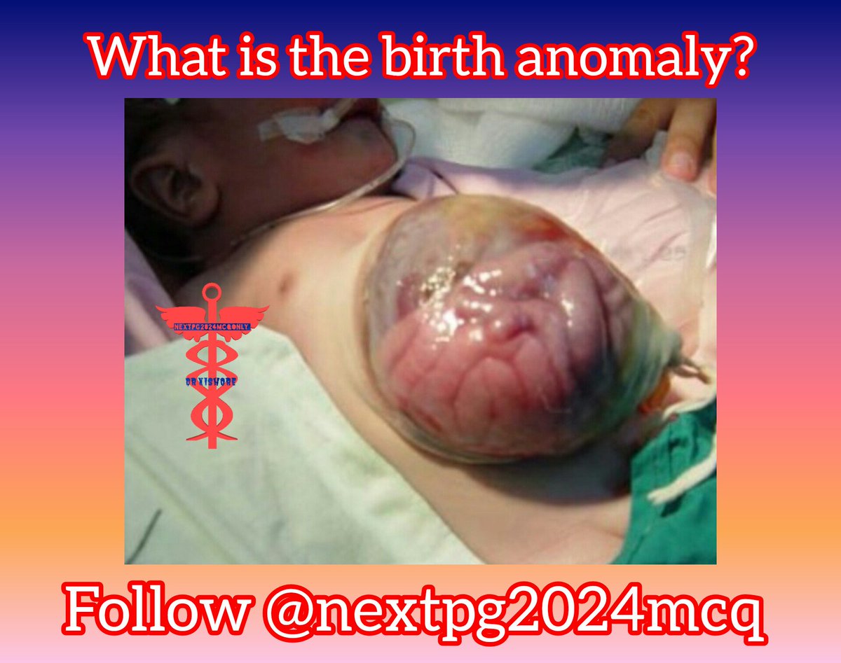 24ptka's tweet image. NEET PG PYQ 16.
#NEETPG2024 
#fmge2024 
#nextpg 
#inicet2024 
#medico
#neetpg
#medicine