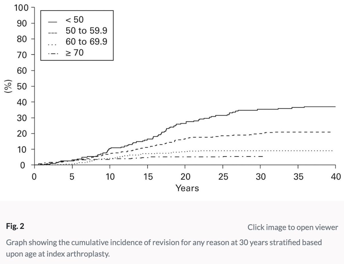 Total #Hip Arthroplasty Lifetime revision risk: <50yrs 35% 50-59yrs 20% 60-69yrs 9% 70+yrs 5% @BoneJointJ buff.ly/3TBA3cf