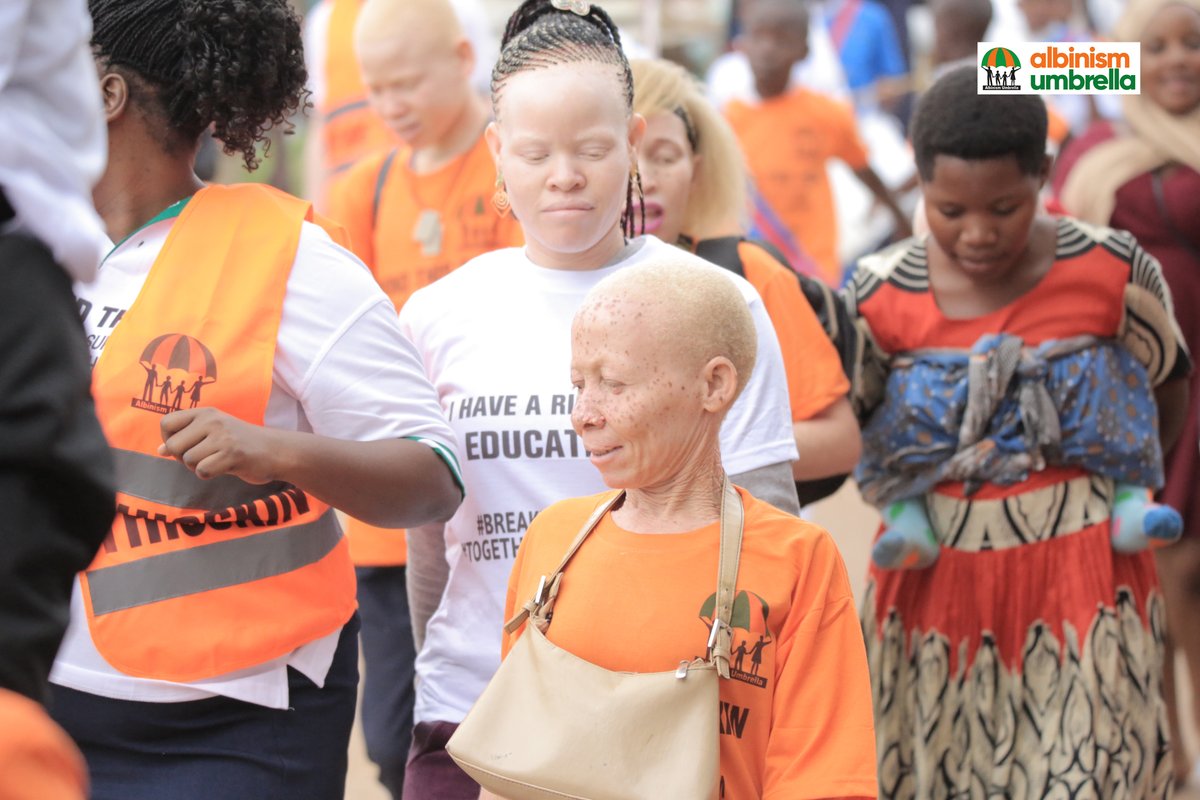 Self advocacy is an important part of empowerment, in many settings persons with albinism experience stigma and discrimination and it can be very difficult to voice out opinions, often persons with albinism will need your support to get their voices heard. #ActionForAlbinism