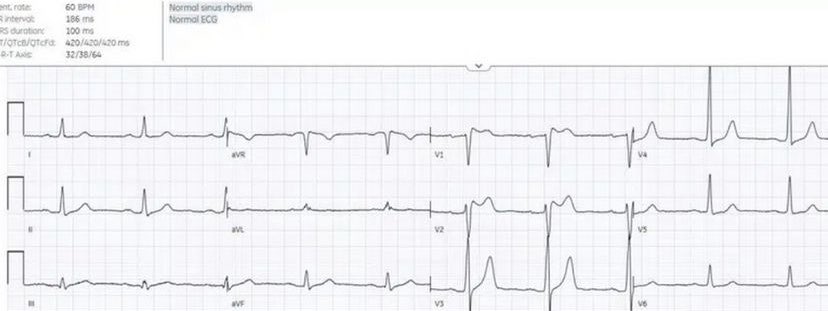 heartsECGcourse tweet media