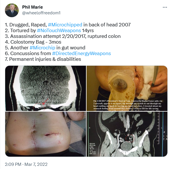 wheeloffreedom1's tweet photo. Human Torture🛰️⚡️is NOT the solution to anything!
It makes the situation worse &amp; they know it!

In a perfect world...
💯Truth, sincere apologies, removal of chips, &amp; forgiveness.

But, we are in the #LastDays...
so, #BiochipTorture just continues, that's all.
#JesusIsComingSoon https://t.co/YPophmaN3o