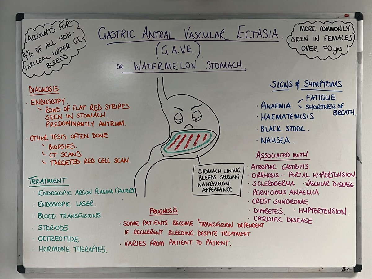 Marion Clark (@marionjclark19) on Twitter photo A review of gave for March’s teaching board in the gastro ward. Sparked some further discussion on recent cases. <a href="/AAAcuteAdvPrac/">Advanced Practice NHS Ayrshire and Arran</a> #gastrotraching A review of gave for March’s teaching board in the gastro ward. Sparked some further discussion on recent cases. <a href="/AAAcuteAdvPrac/">Advanced Practice NHS Ayrshire and Arran</a> #gastrotraching