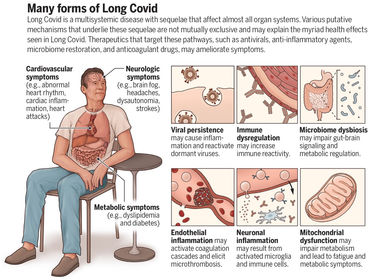 ScienceMagazine's tweet image. A #SciencePerspective by @zalaly and @EricTopol identifies key issues that need to be prioritized in the study of #LongCovid.

Learn more on #LongCovidAwarenessDay: scim.ag/6ez