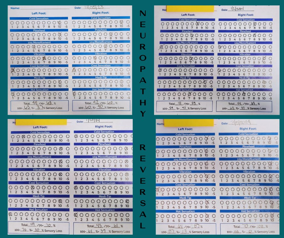 The Results are IN!!!

Sensory loss started at 40%, down to 0%!!!  WOW

Are you ready to face your Neuropathy?

#AllSeasonsHealing
#IntegrativeHealthSolutions
#NaturalWellnessJourney
#WholeBodyBalance
#ChiropracticCareForAll
#HealNaturallyWithAllSeasons
#EmpowerYourHealth