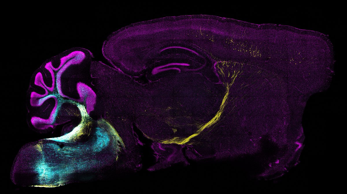DAZZLING! 'The Great Escape: Mapping the path to freedom' by #RussoLab's Dr. Antonio Aubry depicts Axonal projections from inferior olivary nucleus to lateral septum circuit which promotes escape behavior #ArtoftheBrain #BAW2024 VOTE NOW for #CallforImages Image #2 Most💜s wins!