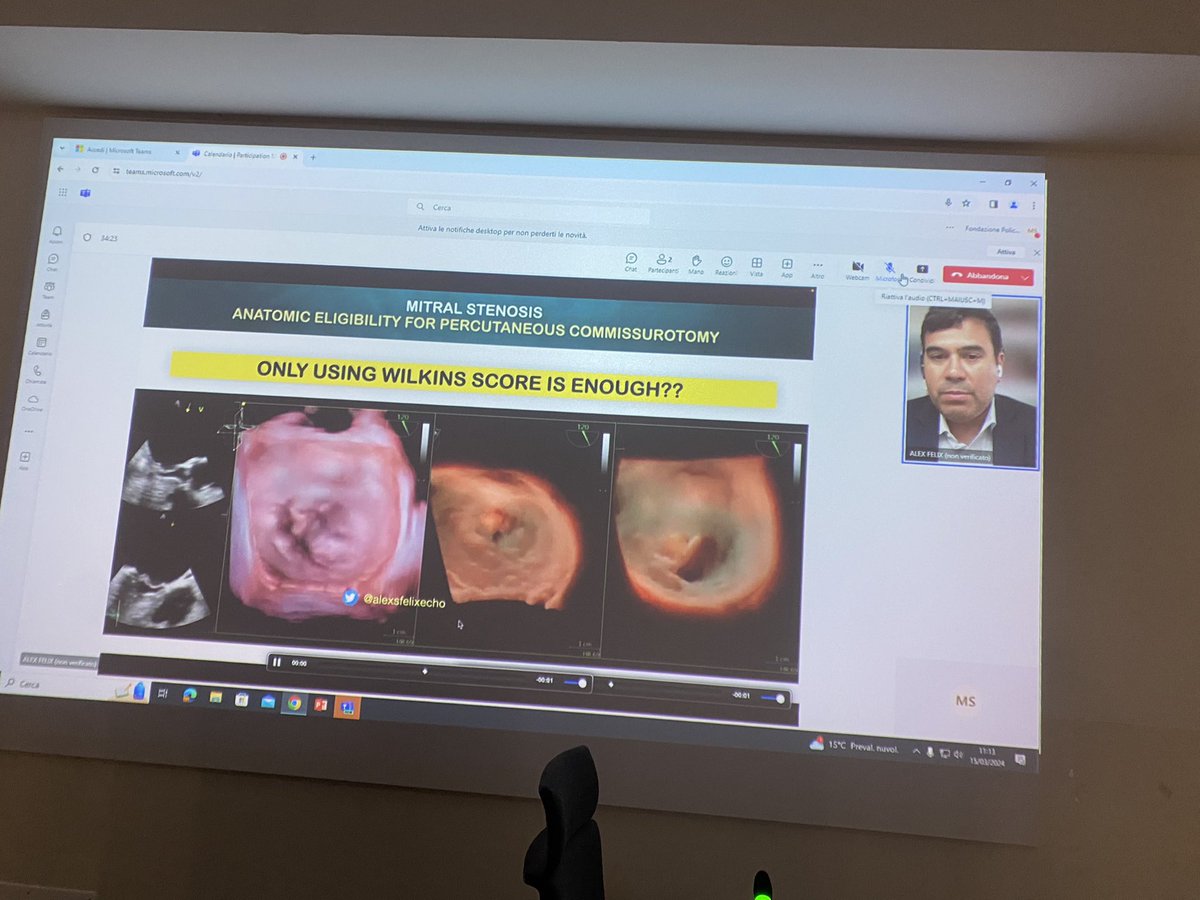 Today @alexsfelixecho held a superb lecture on the role of #echofirst in #MS at our #EchoMasterRome💫💫💫 ✅ great images ✅ amazing teaching points ✅ competence, knowledge, kindness 🙏🏻 thank you so much Alex from your Italian fans 💫💫💫 @Anto_Lombard @GabriellaLocor1