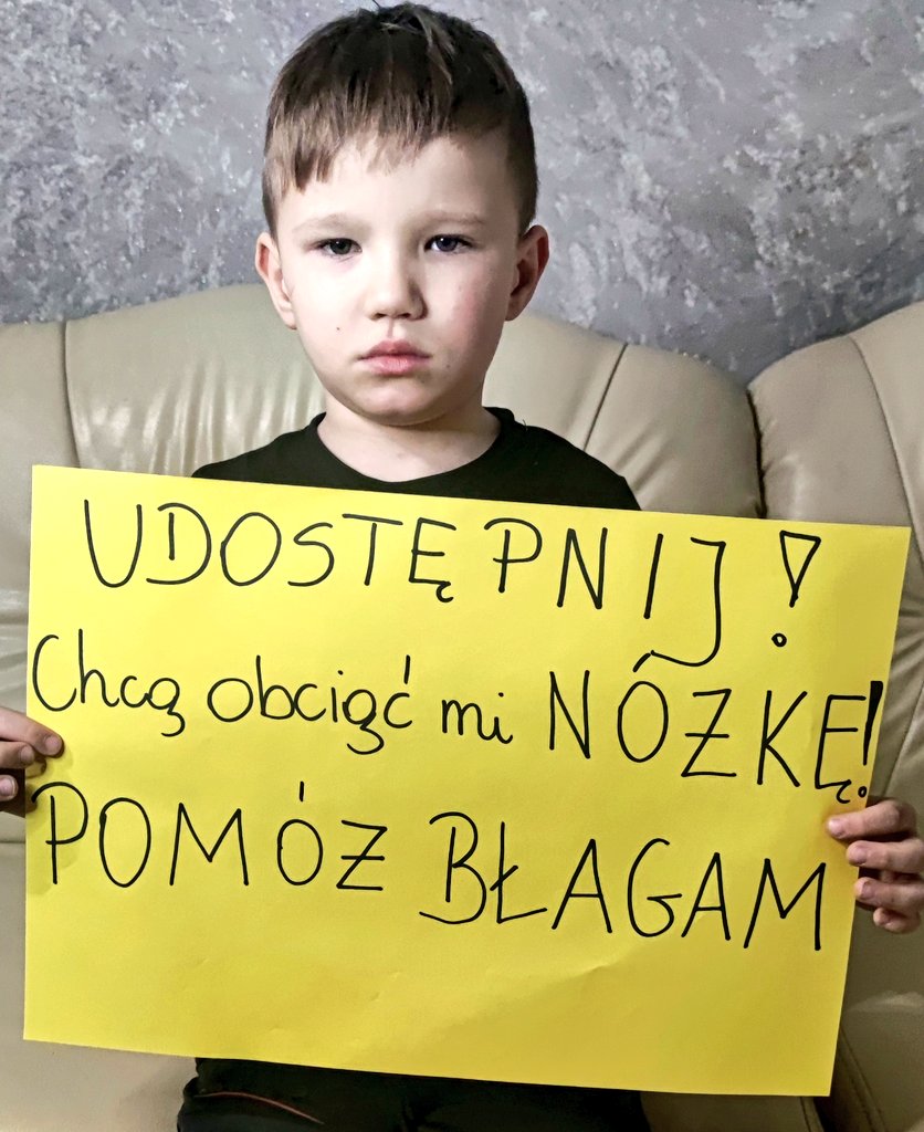 DobroWracaMG's tweet photo. PILNE❗️BŁAGAM Was o RT🙏Chcą obciąć moją nóżkę. Muszę PILNIE trafić na blok operacyjny gdzie przejdę kluczową czwartą operacje. Termin operacji jest zagrożony. Jeśli nie zdążę uzbierać pieniążków do 5 maja ocalenie nóżki w przyszłości będzie niemożliwe. Z całego serca proszę wesprzyj mnie i wpłać cegiełkę tutaj👇
https://t.co/hHspDGv1tF