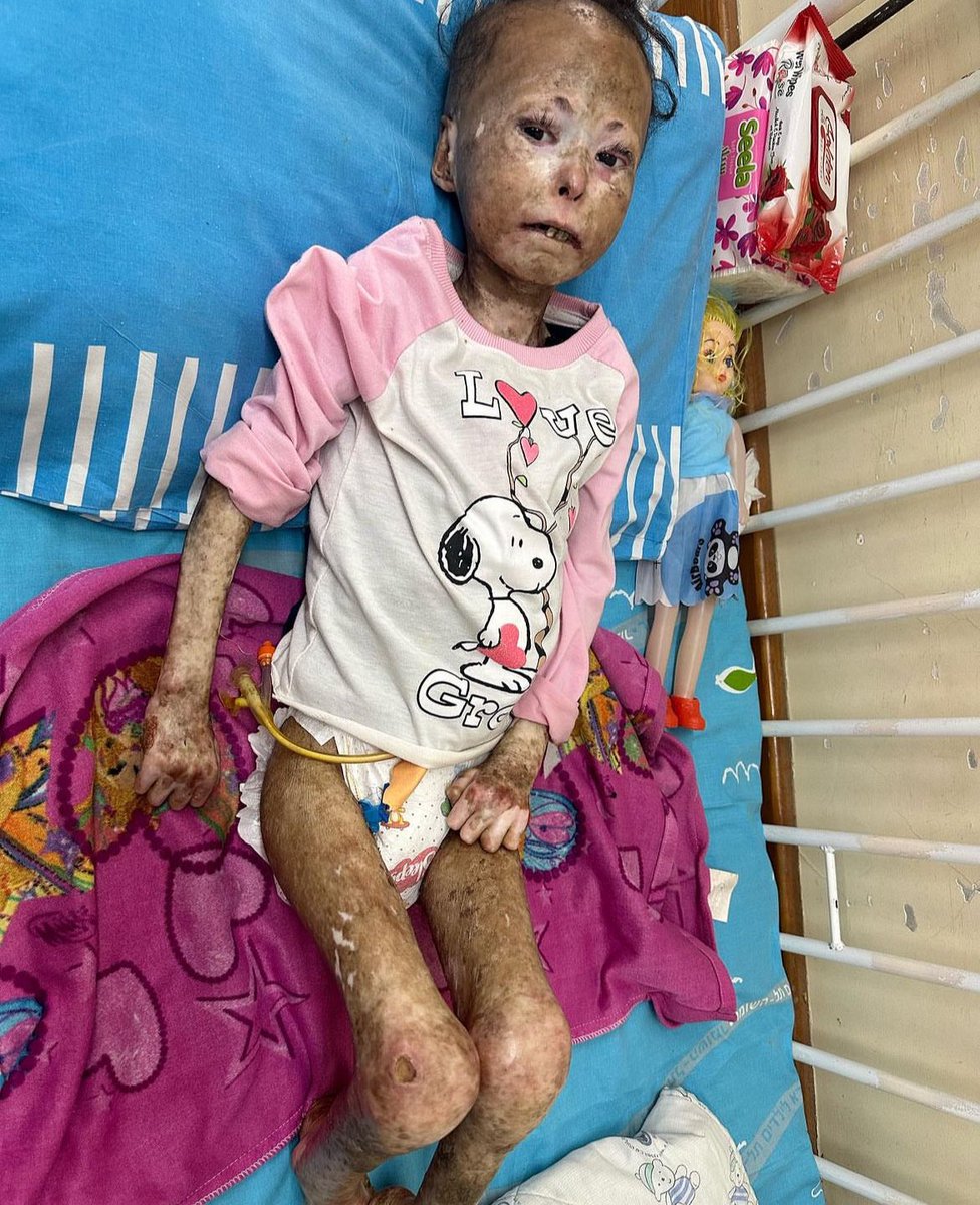 This is a real picture for a kid from Gaza. 

Done by Israel.