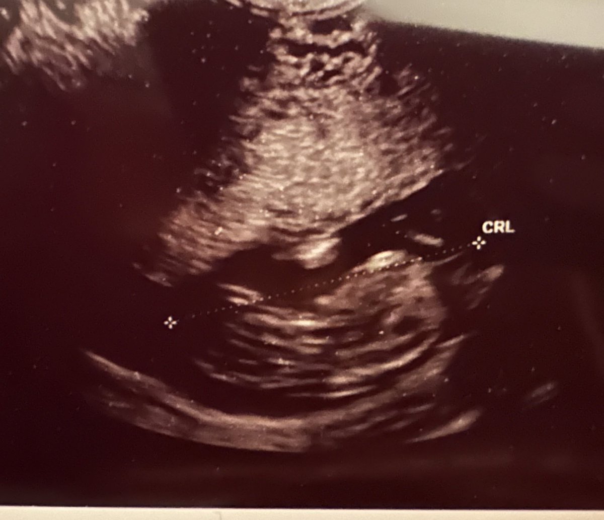 CoachBWils's tweet photo. Right in time for Football season. I’m having my 1st child!! 

“These kids is havin kids” https://t.co/hAuBIpN4Gf