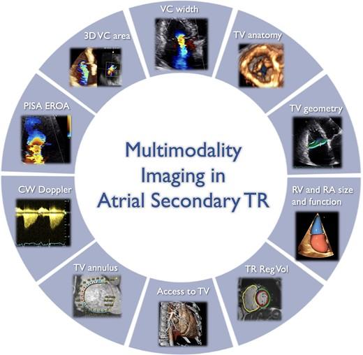 💡🫀ICOT consiglia: paper of the week🫀🧠 💡Atrial secondary tricuspid regurgitation: pathophysiology, definition, diagnosis, and treatment💡 ❗️Leggi il paper academic.oup.com/eurheartj/arti… #cardiology #cardiologyfellow #cardiologia #cardiovascular