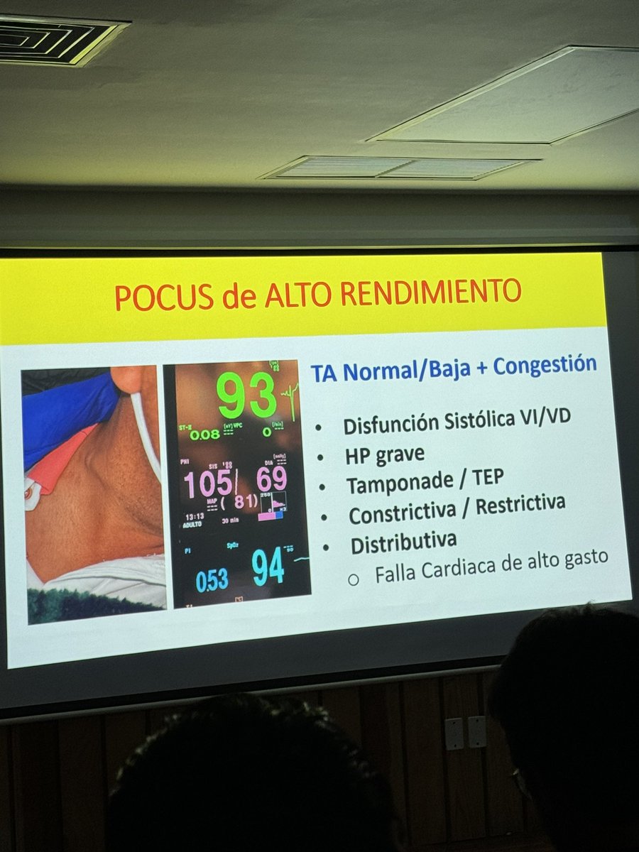 Clase magistral de valoracion del estado hemodinamico por una personalidad de la nefrologia en nuestro pais. Muchas gracias! <a href="/ArgaizR/">Eduardo R Argaiz</a> <a href="/hgm_nefrologia/">NefrologíaHGM</a>