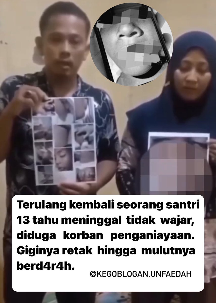 MIRIS BANGET GAES!!

Seorang santri (13 thn) meninggal tidak wajar, diduga korban penganiayaan.

"Giginya retak, mulutnya berdarah, di kaki ada luka melepuh seperti tersulut api" ujar ayah korban
