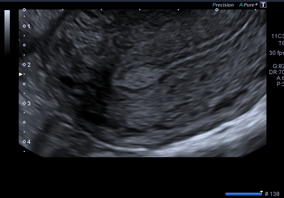 e_sied's tweet image. IETA. Consensos en Ecografía Ginecológica. #LearnDifferent