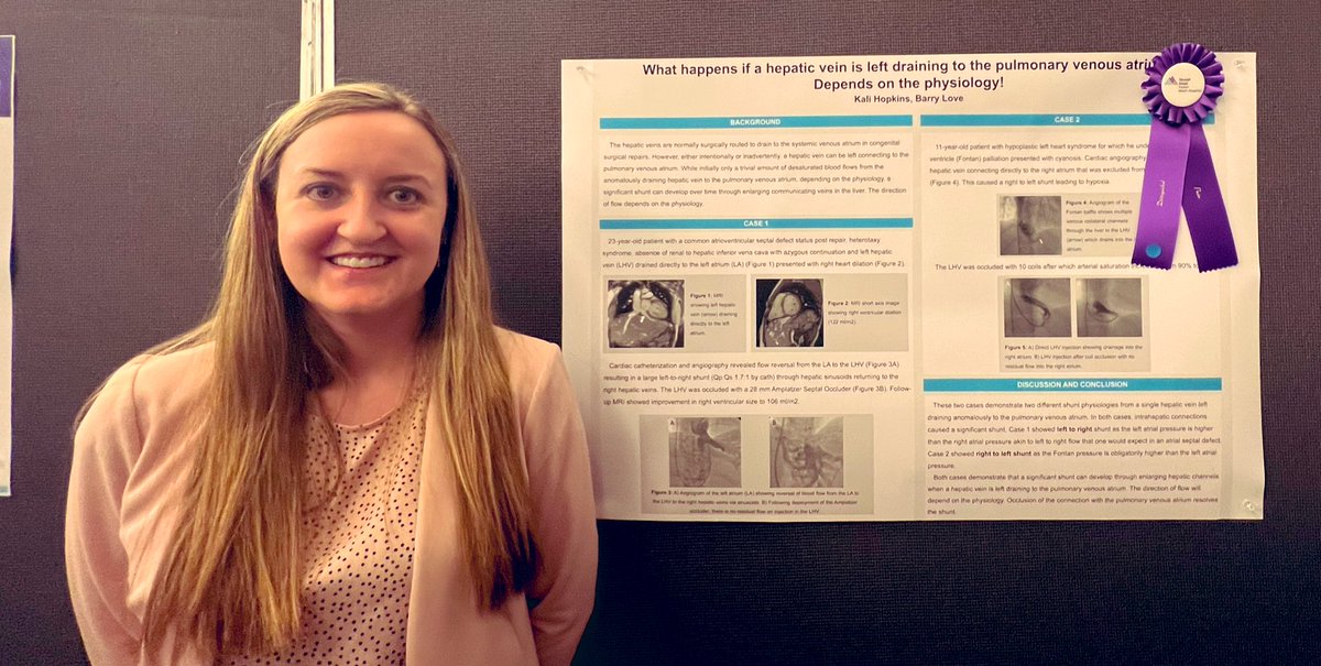 👏 Strong showing by the #ACHD team @MountSinaiHeart Research Day with our stellar residents Dr Saloni Agrawal, Dr Rebecca Fisher and @Kali_Hopkins as always ! #MedEd @DLBHATTMD @MountSinaiPeds #MedEd @DOMSinaiNYC