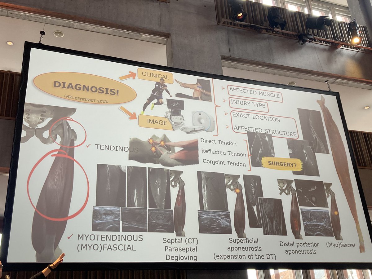 Elke Van den Steen (@elkevandensteen) on Twitter photo There is not 1 rectus femoris injury! Taking muscle injuries to another level! <a href="/carlespedret/">carlespedret</a> #brucosport There is not 1 rectus femoris injury! Taking muscle injuries to another level! <a href="/carlespedret/">carlespedret</a> #brucosport