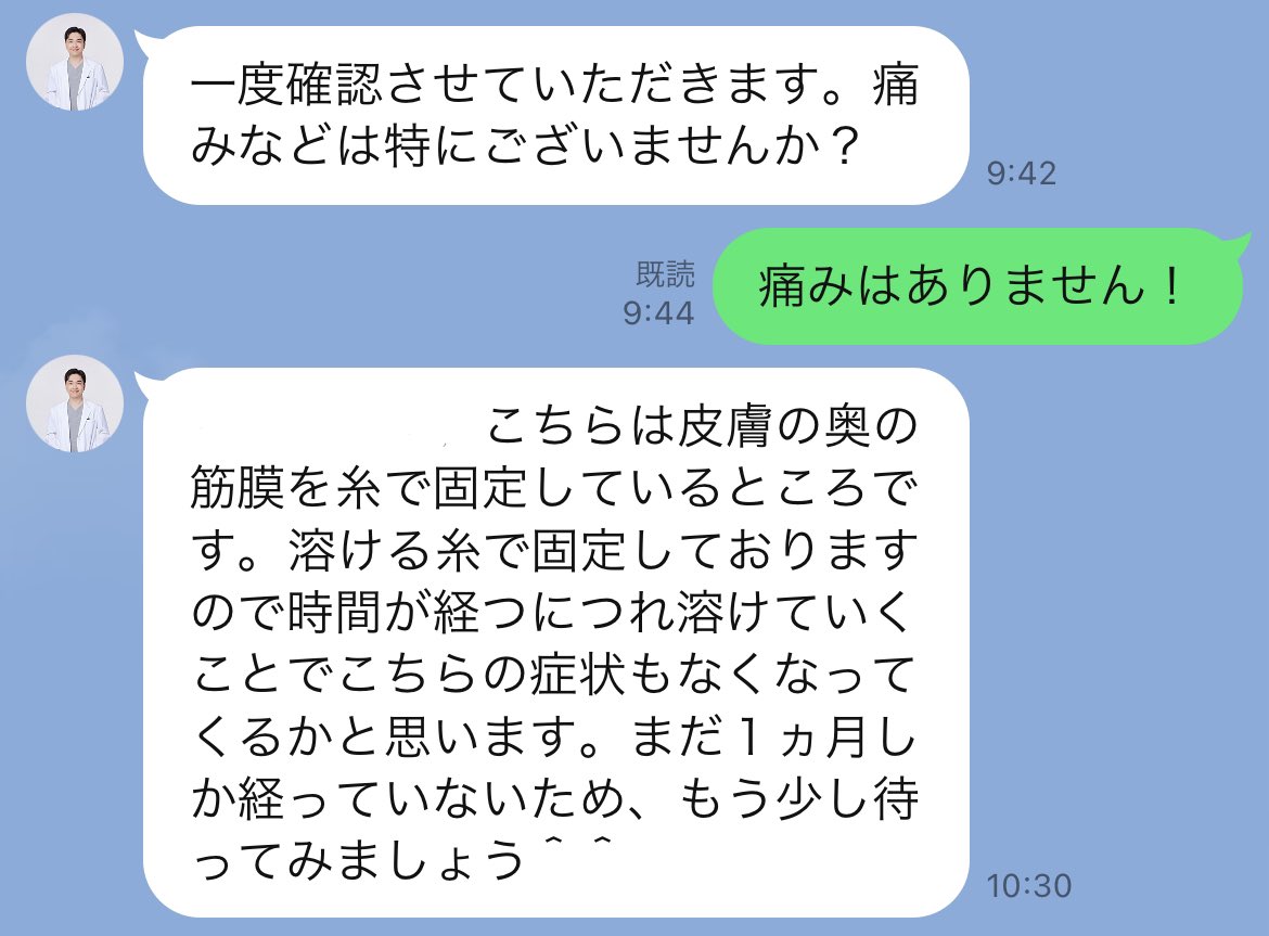 facecompbonjin's tweet photo. @dasipium 笑った時に右側の頬に凹みが出ているのを確認すると、筋膜固定用の溶ける糸だそう！脂肪再配置もしてるし、1ヶ月はまだまだ馴染んでないと。
ちゃんと先生に確認してからレスくれてとっても良心的🌸
インディバは6ヶ月禁止🙅‍♀️首回りまでにしておこ https://t.co/ecfju4IR5x