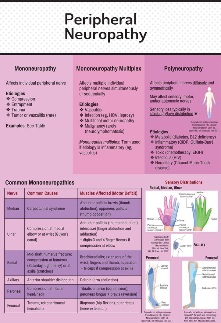 Peripheral neuropathy is a common condition. This typically gives “neuropathic pain”, which usually manifest as: burning, throbbing, stabbing, electrical pain with numbness/tingling and altered sensation (decrease or increase sensation to pain). 
#NeuropathicPain #Neuromodulaiton