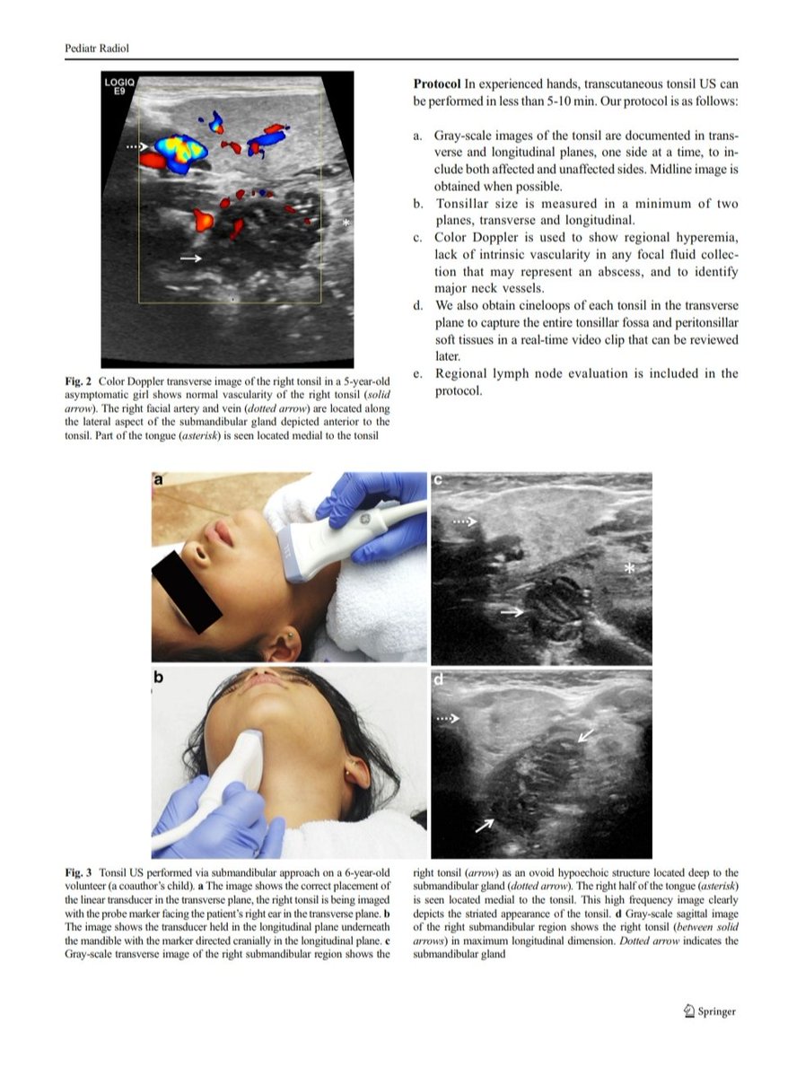 JMMR83's tweet photo. Ultrasonido en amígdala
@NephroP @OswaldoRamosN @DraSadhy @trigeminy_henry @TaotePOCUS @anaseguragrau @y_interna @yaletung @SonoSamMD @curromir @zbriote @PierpaDiNick @ABCDEcografia @jpalacinp @jorgezzb @AlvarezHigueras @ignaciomsb @mberchid @EcosemfyC @USPed_Latam https://t.co/sPCiaKmOW3