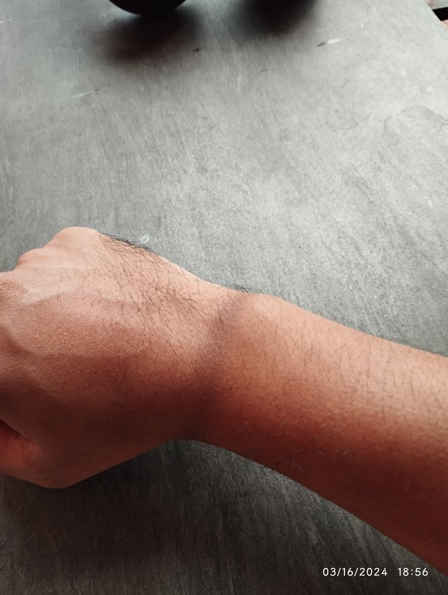 nazriOscariot's tweet image. gap antara glove dengan arm sleeve. 
terbakar matttt...
#riderlife