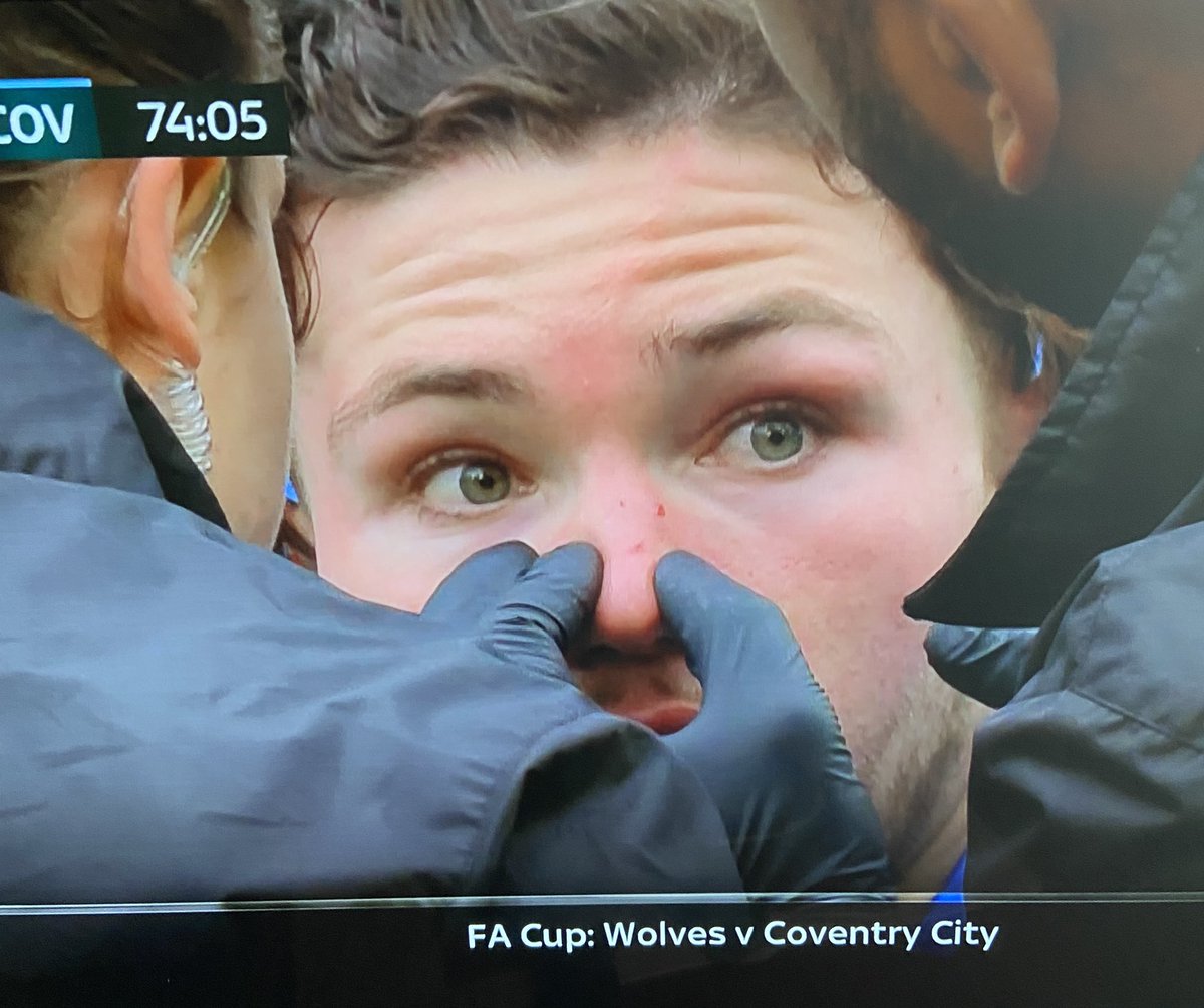 Wolves v Coventry today in FA Cup. Very high boot clashes with Coventry player and damages his nose. Ref says no action needed as does VAR. Now tell me Yang deserved his Red card for a lesser offence. Beaton is a joke.