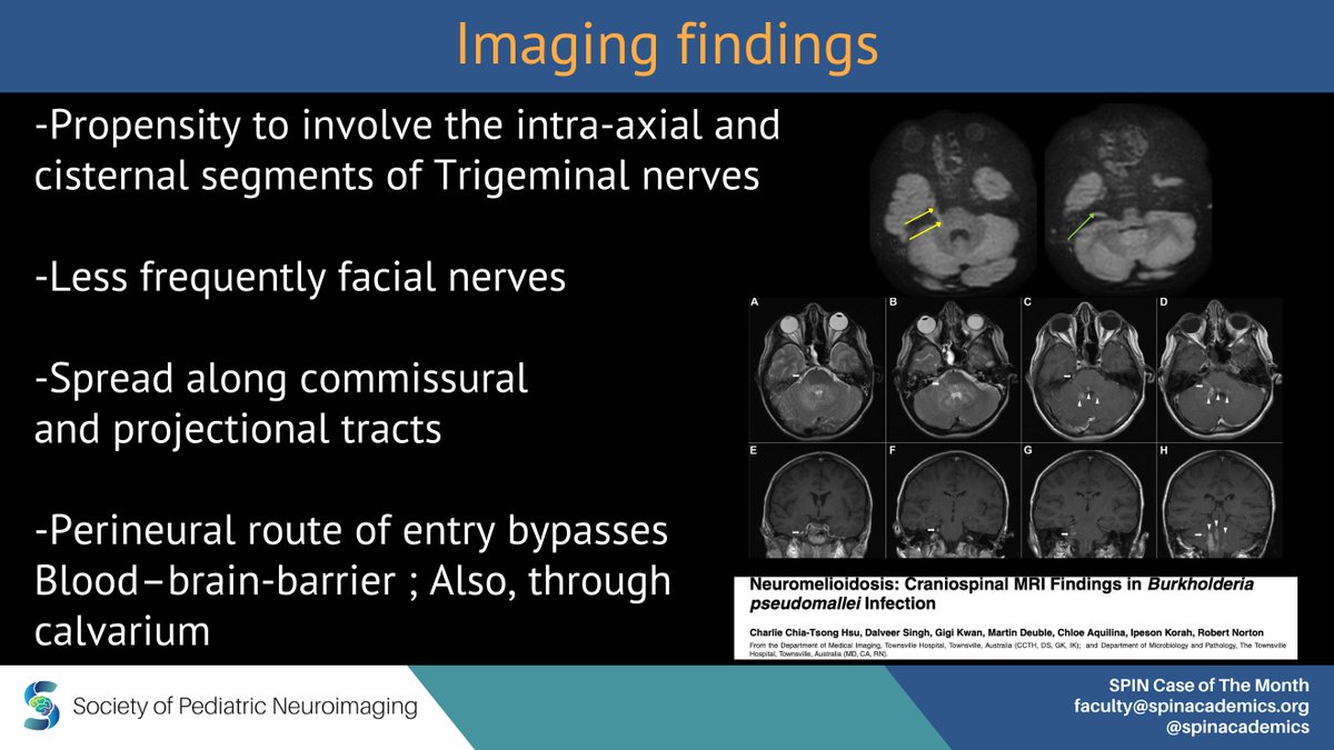 SPIN Monthly Here’s our case for March! Learn more about Neuroinfectious Disorders. spinacademics.org