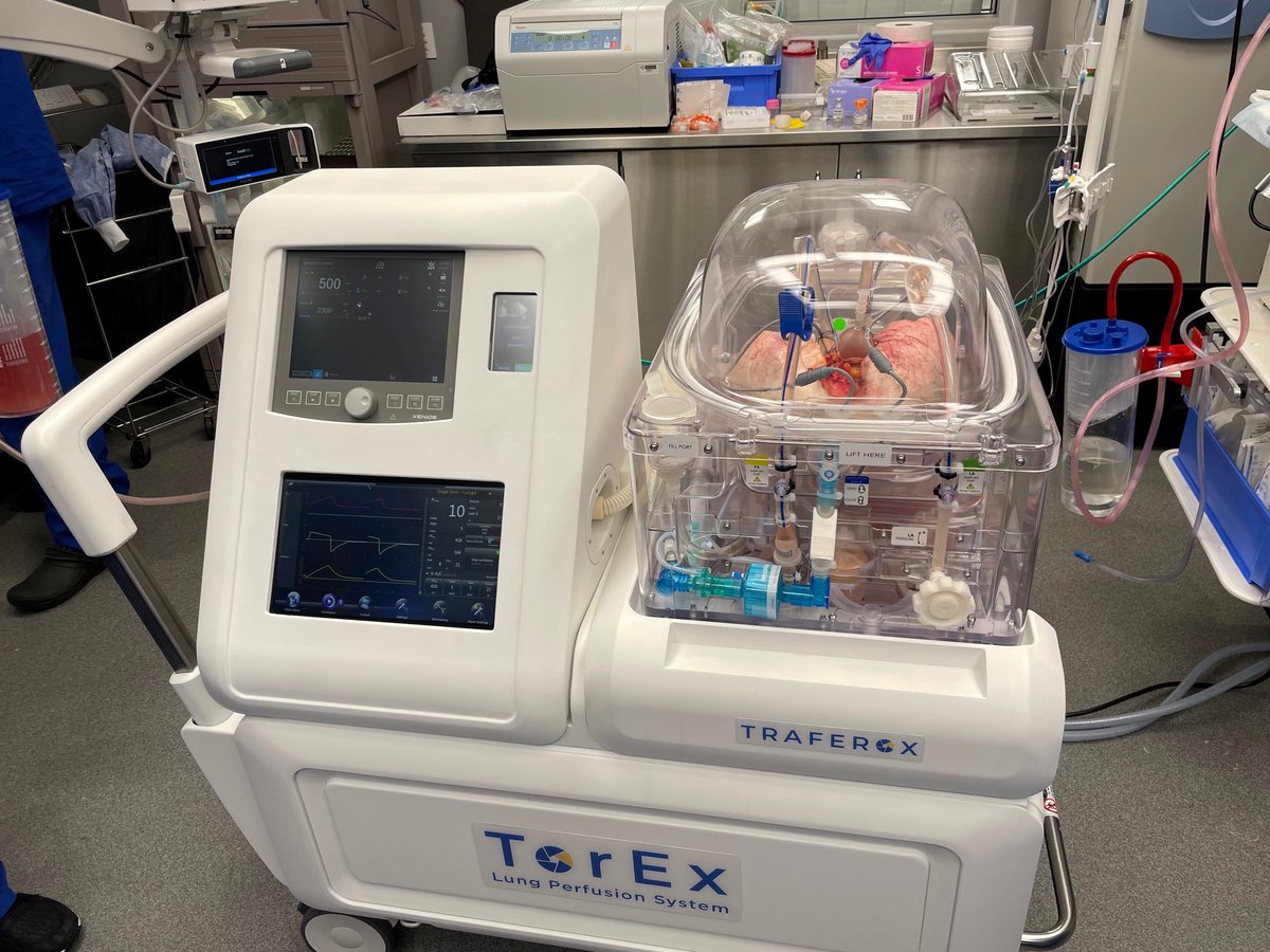 We have come a long way! Toronto Lung Transplant Program performed 1000th ex vivo lung perfusion! Saving lives.  <a href="/UHN_Surgery/">UHN Sprott Department of Surgery</a> <a href="/UHNTransplant/">Ajmera Transplant Centre UHN</a> <a href="/SKeshavjee/">Shaf Keshavjee</a> <a href="/UHN/">University Health Network</a> <a href="/uhnfoundation/">UHN Foundation</a>