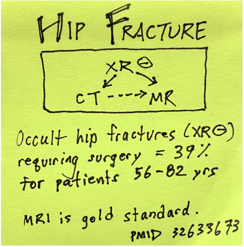 Don’t write off a hip fracture just because the x-ray is negative. @M_lin says occult hip fractures requiring surgery occur in 39 percent of older patients. Here’s what to do if the x-ray comes back negative. tinyurl.com/yc5z55fu #FOAMed
