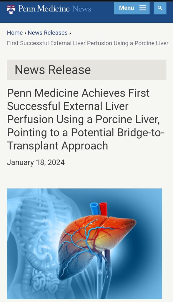 Oceanworldfree's tweet image. #RivalryIntensity anywhere #neckandneck

A genetically altered pig liver to a brain-dead person for #xenotransplantation

🇨🇳The world "1st case" on 03/10-13/2024 "living" for 96 hrs
🇺🇲On 01/14-18/2024 "The 1st Successful" the organ "functioned normally" for 72 hrs
