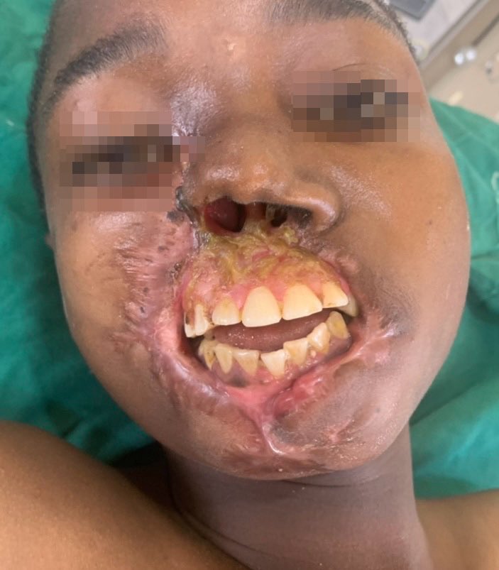 Dr. César Casado tweet media