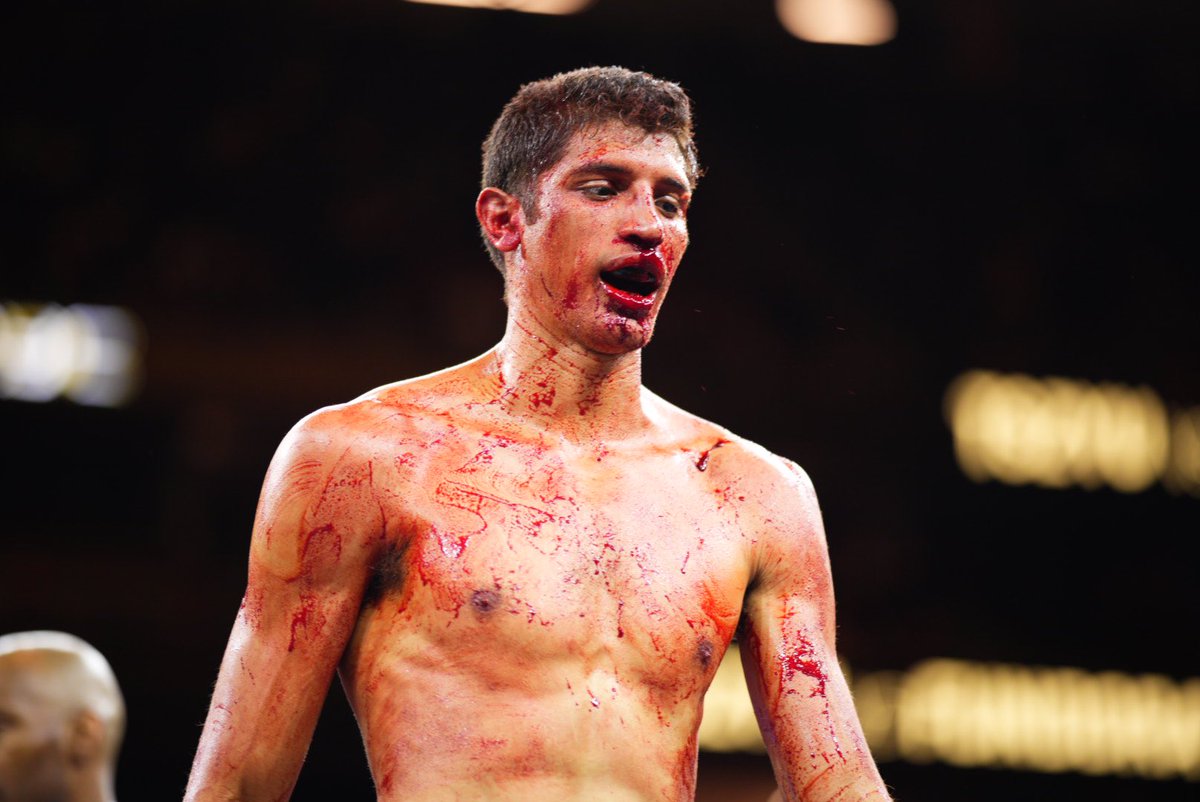 ¡UPSET DEL AÑO! ¡Al que invitaron a la fiesta, se terminó comiendo la torta! ¡TREMENDA victoria de Sebastián Fundora! ¡El Infierno está de festejo! ¡Hoy, su Torre, se elevó hasta el cielo! 🗼🥊 #TszyuFundora