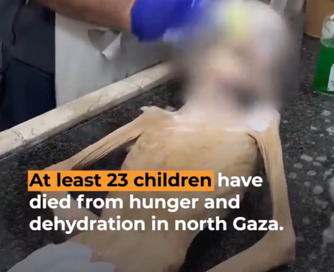 At least 23 children have died from hunger and dehydration in Gaza. This is what starvation looks like in Gaza.