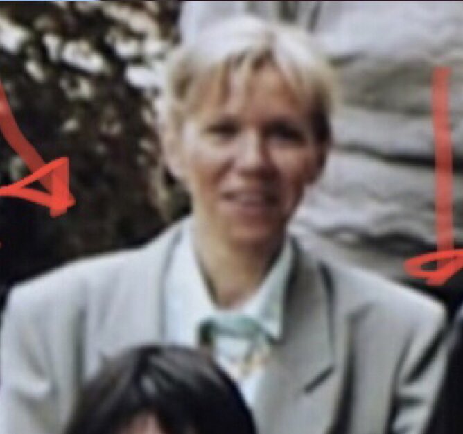 boujemaa_b's tweet image. Implants des peaumettes, ça retend la peau mais c’est plutôt utilisé pour les transsexuels qui veulent devenir femme. Je trouve ça tres moche, ça me repulse les peaumettes saillantes. 
C’est très gonflé au début comme ac le botox.
#JeanMichelTrogneuxgate 
#Bitox #JeanMichel