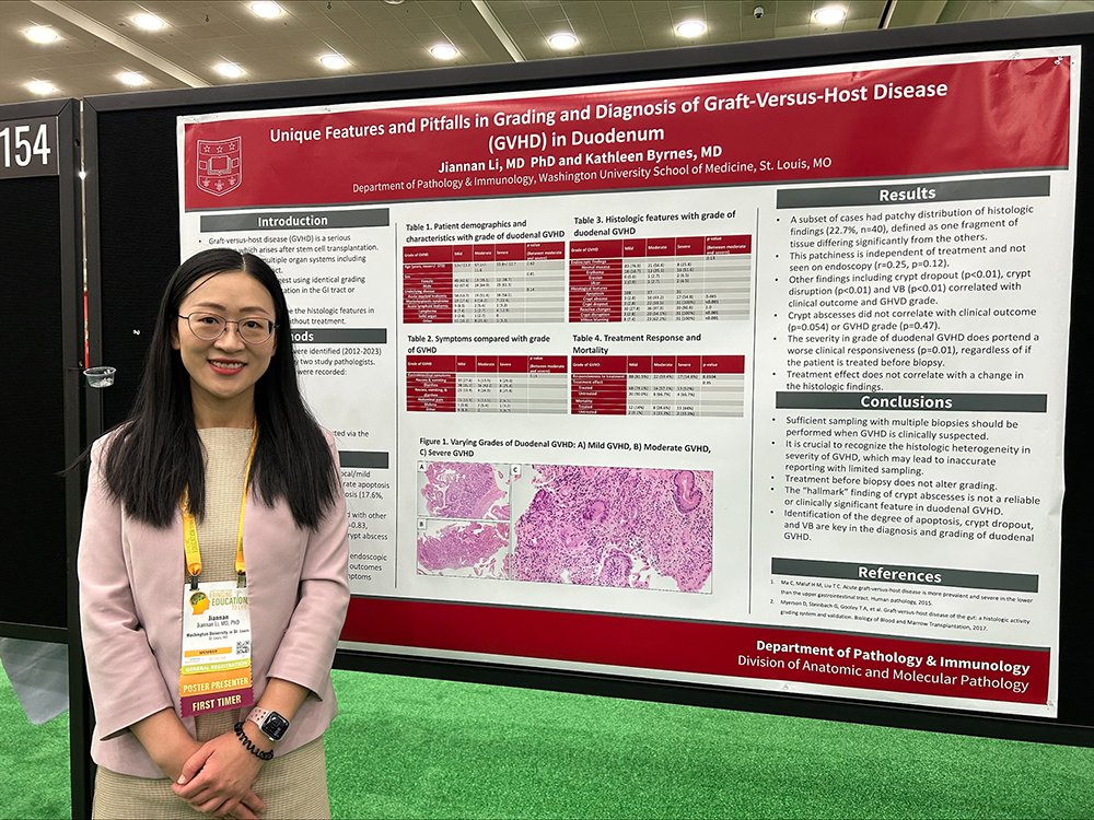 One more from #USCAP2024: @JiannanliMDPhD, a PGY-2, presented a poster, '“Unique Features and Pitfalls in Grading and Diagnosis of Graft-Versus-Host Disease (GVHD) in Duodenum.' Congratulations, Dr. Li! #washupathedu @wusm_pathology