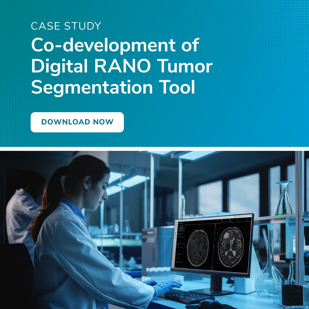 Delve into the collaborative efforts of the University of Edinburgh and QMENTA as we pioneer a digital approach to performing and managing clinical trials on neuro oncology. 🔬🧠 Discover the future of tumor assessment: bit.ly/3Tot7ig #DigitalRANO #NeuroOncology