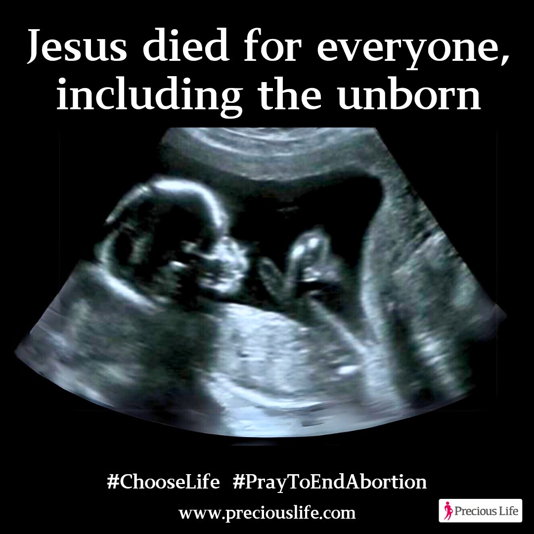 Jesus died for everyone, including the unborn.

#chooselife #praytoendabortion #GoodFriday ✝️