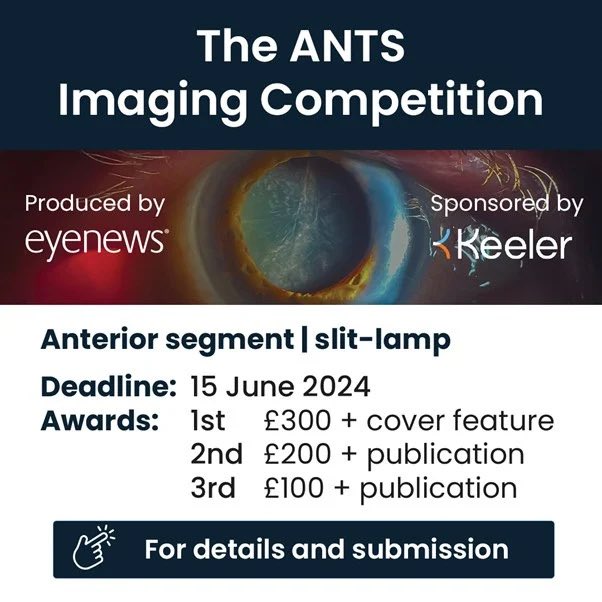 Eye News (@eyenewsmag) on Twitter photo We’re excited to announce a project we’re kicking off in collaboration with <a href="/KeelerLtd/">@keelerglobal</a>: the ANTS Imaging Competition. The competition is open to everyone with an interest in imaging. For more details, visit bit.ly/4abHhcI
#eyenews #Competition #Ophthalmology We’re excited to announce a project we’re kicking off in collaboration with <a href="/KeelerLtd/">@keelerglobal</a>: the ANTS Imaging Competition. The competition is open to everyone with an interest in imaging. For more details, visit bit.ly/4abHhcI
#eyenews #Competition #Ophthalmology
