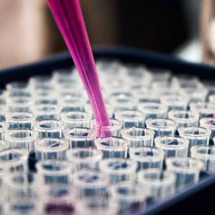 Why are researchers looking at this? 

A molecule inside cells (called SEH1) switches on genes to kick-start the production of myelin.   

Researchers think that when the survivin protein binds to SEH1, it could stop cells making myelin.  

mssoc.uk/3vu0rLS

#StopMS