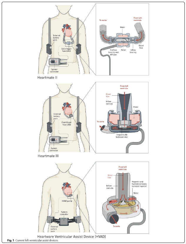 ESICM's tweet photo. 1/ @yourICM's highlights:

🔹OPEN ACCESS ~ British societies guideline on the management of emergencies in implantable left ventricular assist device recipients in transplant centres 👉 https://t.co/RsTPNuowh2
🔹Autonomy 👉 https://t.co/zwpBgzCEsy https://t.co/Py9rI8EkG9