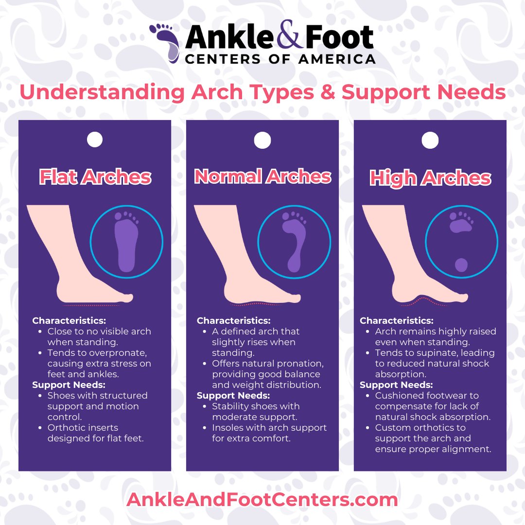 Understanding your arch type is key to stepping comfortably in Franklin, TN. 🦶 Whether you have flat feet, high arches, or something in between, our latest post sheds light on how to support your unique steps. 👣
