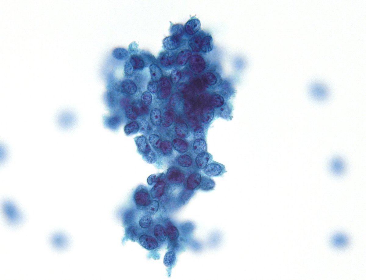 Syed Z. Ali tweet media