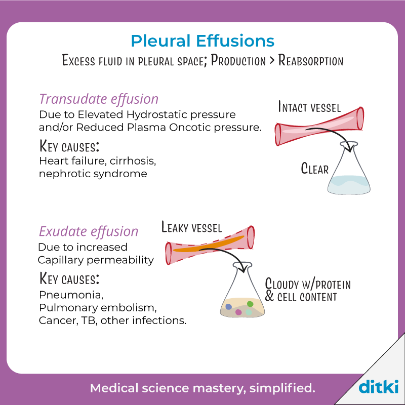 What are some signs/symptoms of pleural effusion? Learn more: l8r.it/nkks #ditki #usmle #meded #medschool #medstudent #highered #pathology #pleura #respiratorypath #nursing #pance #physicianassistant #osteopath #allopath #medicine #science #healthscience #nurse