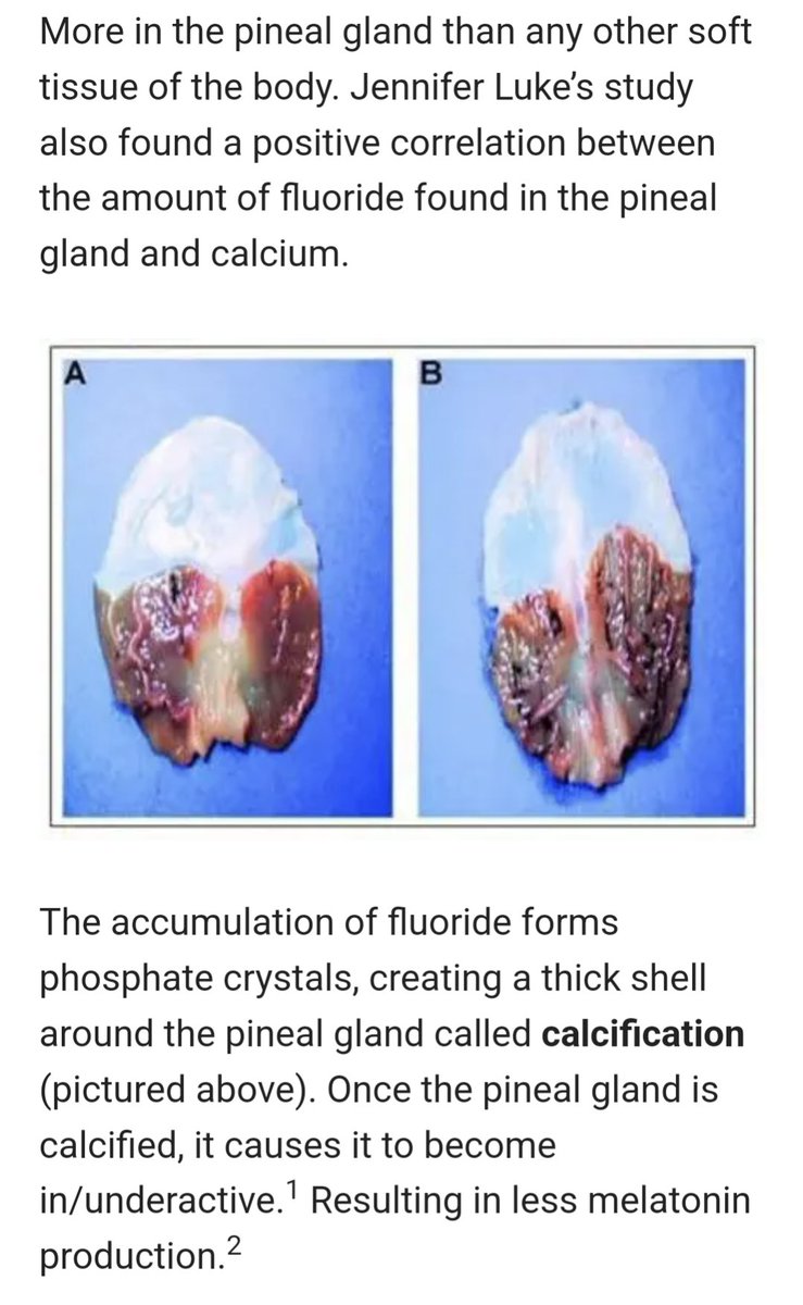 hotepfederales's tweet image. PSA. #WeOutside #GoOutside #HotepNation 
1. Avoid public water sources and drink filtered water! truthaboutfluoride.com/bottled-water-…
2. Get plenty of direct sunlight exposure! Vitamin D supplements work also for folks without sufficient sunlight.
3. Exercise Regularly 
4. Consume Ca foods!