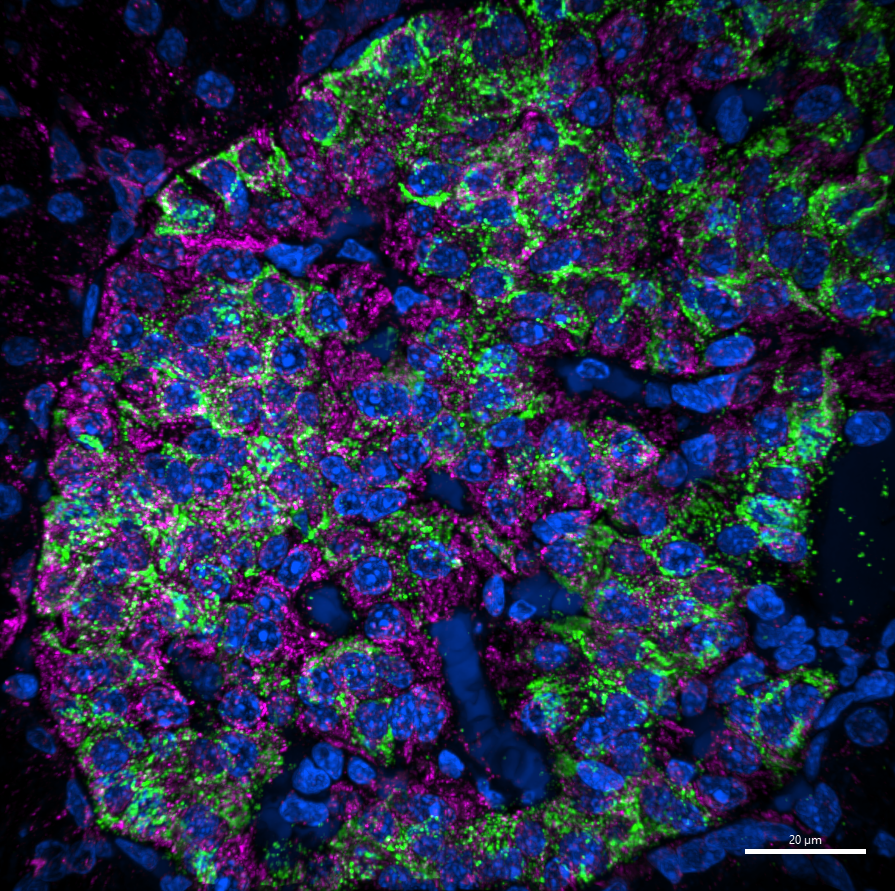 Happy #FluorescenceFriday! We love this image from Darian Carroll @BetaCellBelle in the @GannonLab taken on the CISR's new @NikonInst SDC with SoRa! 🤩NHP islet - insulin in green, mitochondria in magenta, & DAPI in blue. Check out the resolution on those insulin granules! 🔬💚