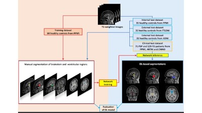 Deep Learning–based Approach for Brainstem and Ventricular MR Planimetry: Application in Patients with Progressive Supranuclear Palsy doi.org/10.1148/ryai.2… <a href="/unibait/">Uniba.it Aldo Moro</a> <a href="/KingsIoPPN/">Institute of Psychiatry, Psychology & Neuroscience</a> #brainstem #MRI #ML