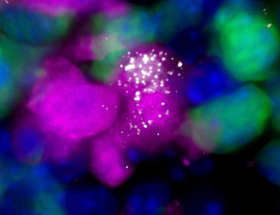 Science Immunology (@sciimmunology) on Twitter photo Single-molecule fluorescent visualization in B cells shows how T cells induce Myc transcriptional bursts during B cell selection. <a href="/WeizmannScience/">Weizmann Institute</a> <a href="/HebrewU/">Hebrew University</a> scim.ag/6pw Single-molecule fluorescent visualization in B cells shows how T cells induce Myc transcriptional bursts during B cell selection. <a href="/WeizmannScience/">Weizmann Institute</a> <a href="/HebrewU/">Hebrew University</a> scim.ag/6pw