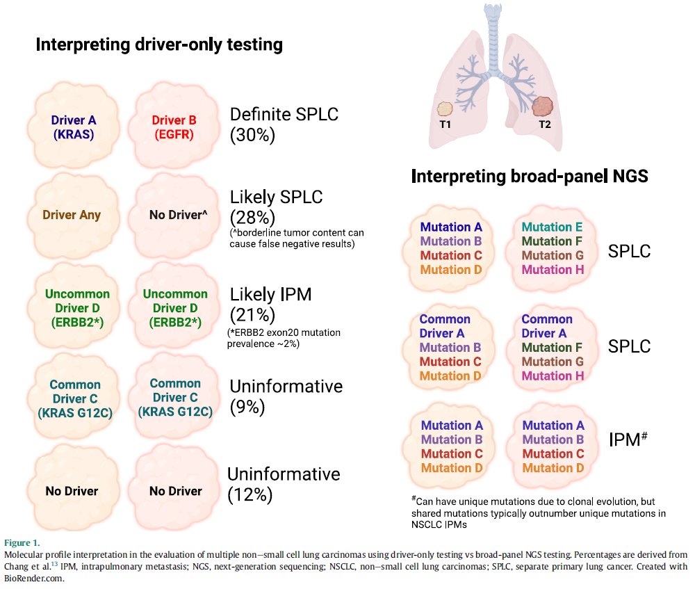 The final version of our article on multiple lung carcinomas is now posted @ModernPathology. Please check it out - it is open access! doi.org/10.1016/j.modp… @DrNetto @smlungpathguy #PulmPath @PulmPathSoc @MSKPathology