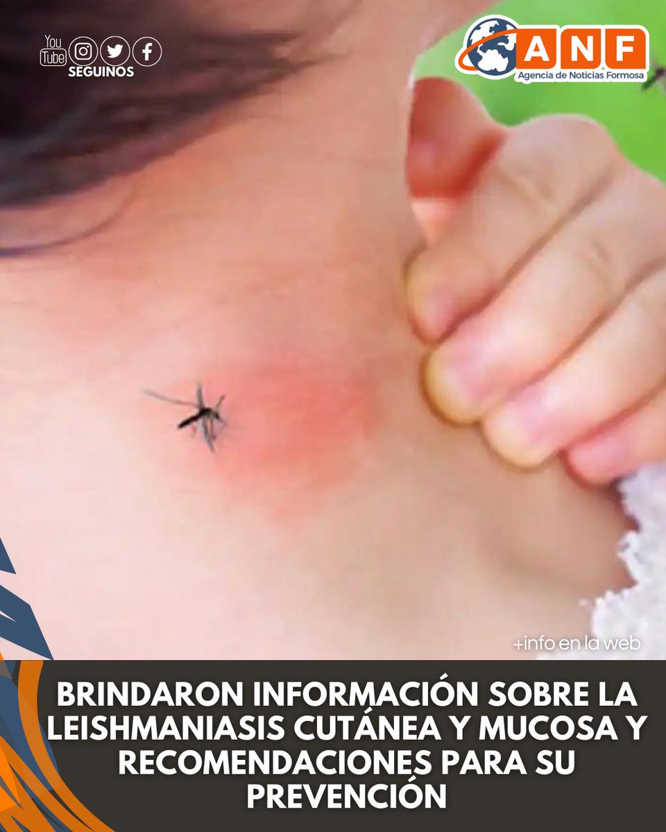 NoticiaFormosa's tweet photo. ⭕️Desde el Ministerio de Desarrollo Humano, dieron a conocer a la comunidad de qué se tratan la leishmaniasis cutánea y la leishmaniasis mucosa, dos de las tres formas principales que presenta esta enfermedad junto a la leishmaniasis visceral.
.
.
.
📌+Info en la web https://t.co/bPU1yWeK3S