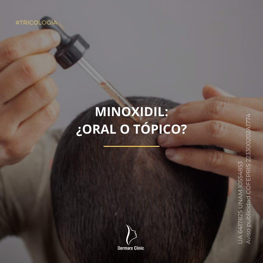 El minoxidil continúa siendo el fármaco de elección para estimular el crecimiento capilar.
#trichology #tricologia #dermatologiacapilar #dermatology #dermatologia #dermatologist
#dermatologo #dermarxclinic #dermacdmx #cdmx #dermatologocertificado