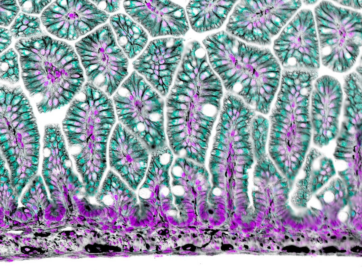 #MicroscopyMonday featuring intestinal villi in a neonatal 🐁. 

#pathart #histoart #sciart #bioart #microscopy #intestine #immunofluorescence